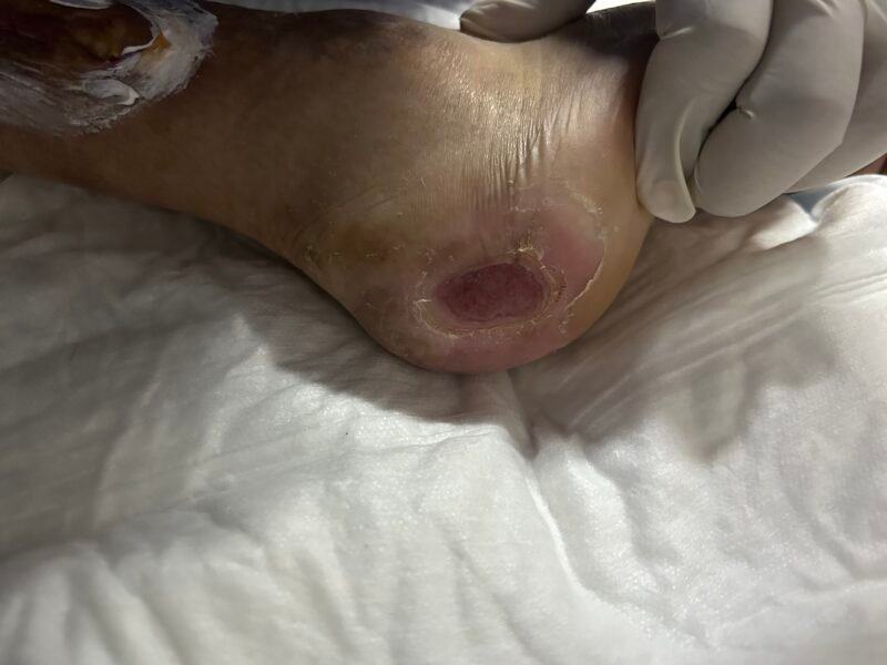 Técnico en Enfermería